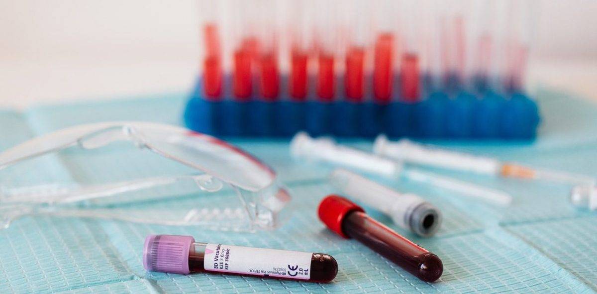 anemia-w-ciazy-objawy